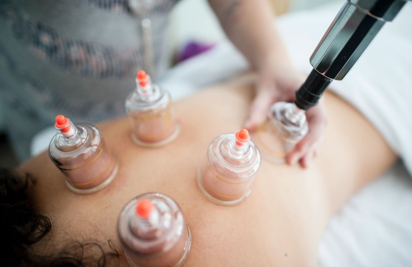 cupping therapy Bangkok